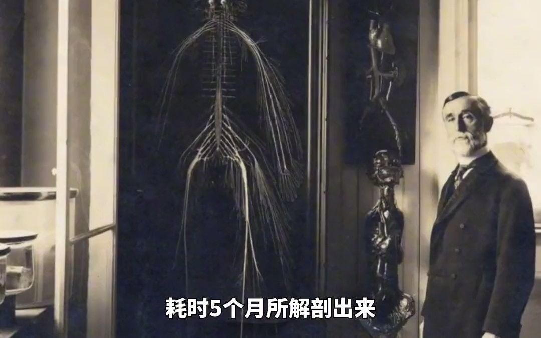 [图]世界上第一具完整的人体神经系统标本，它在1888年由德雷克塞尔大学2名医学生在一具遗体中耗时5个月所解剖出来。#科普 #神经系统 #人体奥秘 #神经 @抖音博士