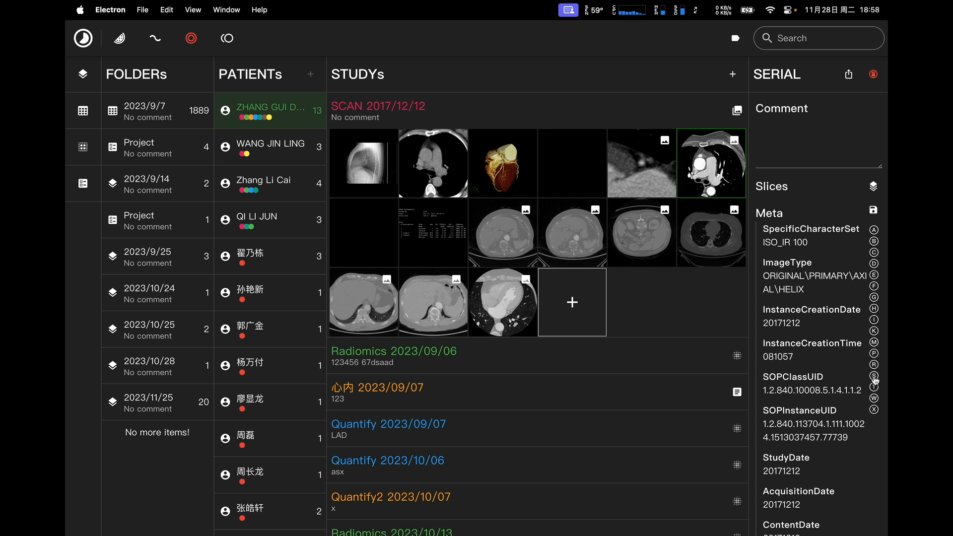 更聪明的图像分割工具 TIMESlice v4.11.0更新 下载地址:https://slicedoc.netlify.app/哔哩哔哩bilibili