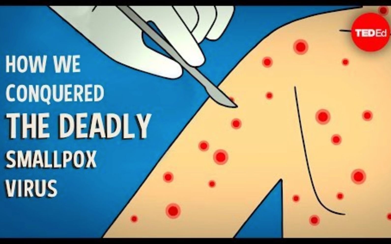 【TedED】我们如何战胜致命的天花病毒 How We Conquered The Deadly Smallpox Virus哔哩哔哩bilibili