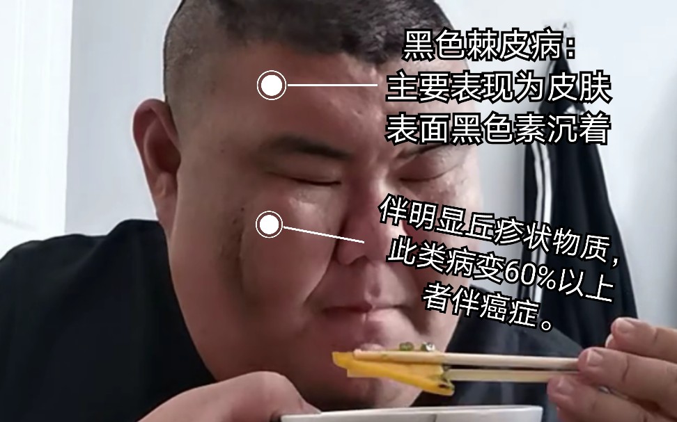 快手猪皇每日必喽肥肉