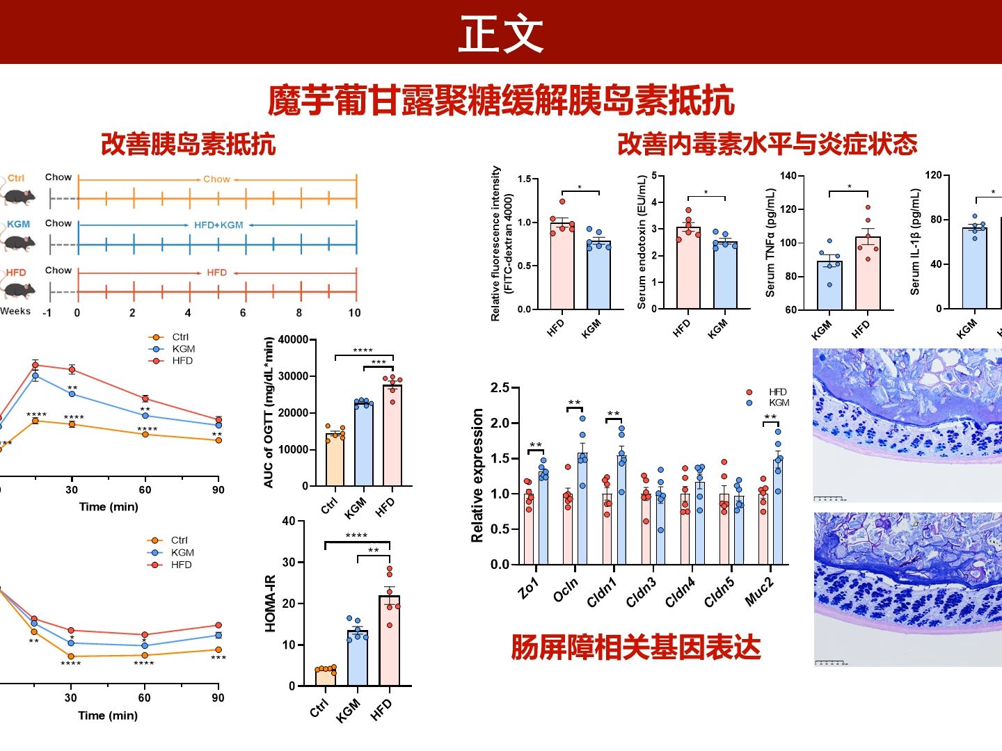 iMeta | 南昌大学聂少平团队揭示葡甘露聚糖通过调节肠道共生菌改善胰岛素抵抗的机制哔哩哔哩bilibili