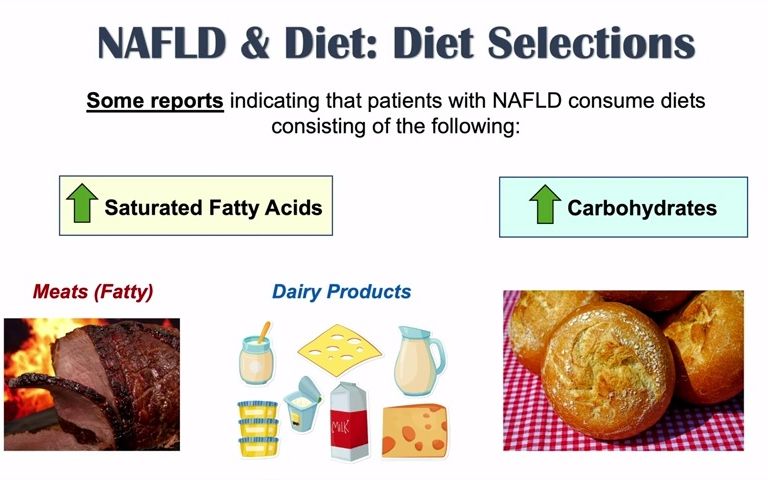 [图]Non-Alcoholic Fatty Liver Disease & Diet Diets to Prevent and Reduce Severity