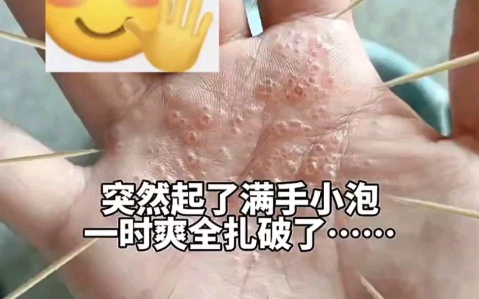 抠手的快乐谁懂??哔哩哔哩bilibili