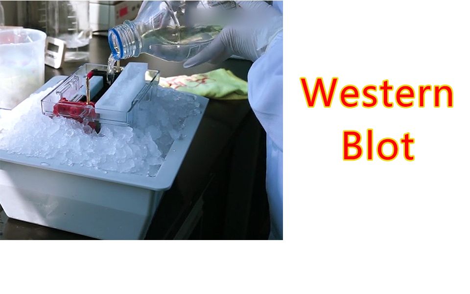 【实验】Western Blot,WESTERN印迹原理,敷抗体,曝光,垂直槽式湿转法,水平半干转法操作原理哔哩哔哩bilibili