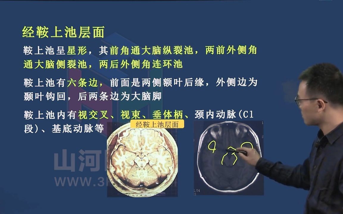 39放射医学高级职称考试:神经系统影像解剖四 山河医学网