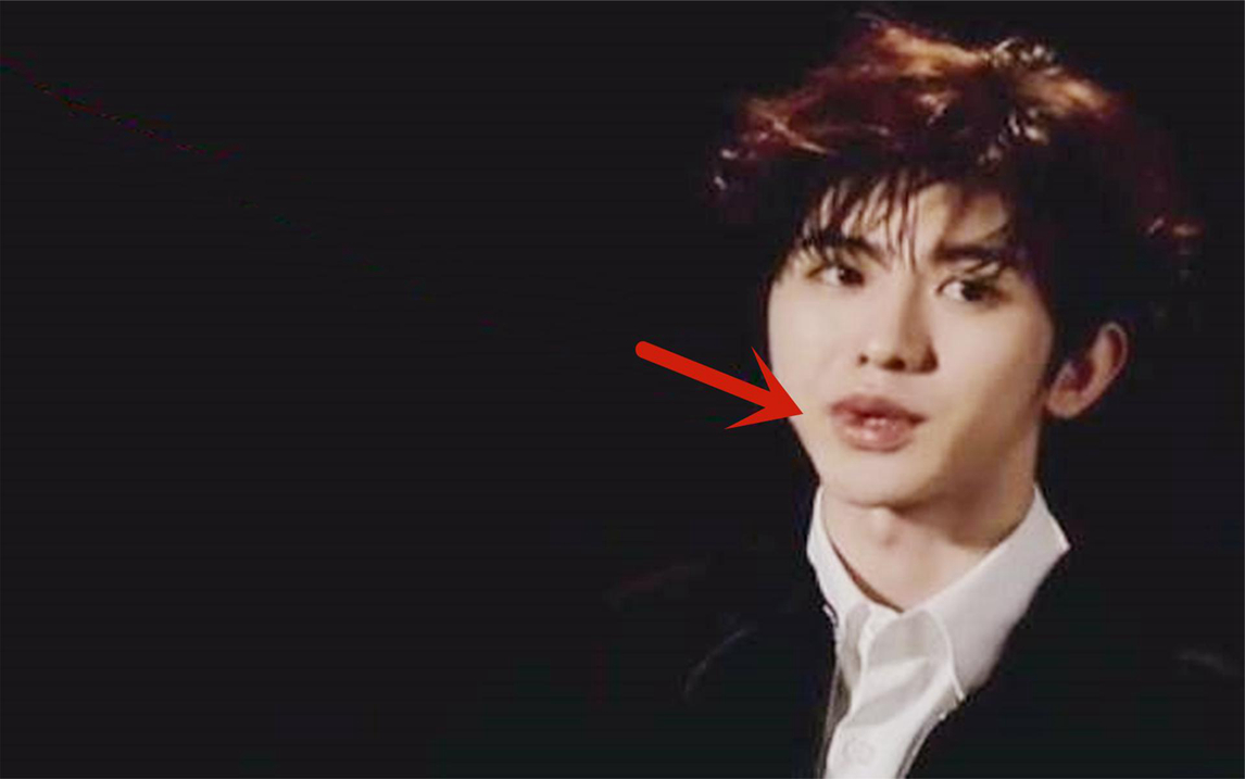 整容的后遗症蔡徐坤接受采访时嘴唇突然变形,下秒慌忙伸手捂嘴