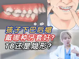 Download Video: 义乌整牙丨孩子下巴后缩戴哪种牙套好？twinblock矫治器or隐形牙套？