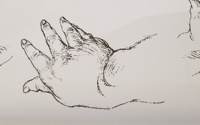 【伯里曼人体结构】28.p262-271 拳头 与手相接的指关节 婴儿的手