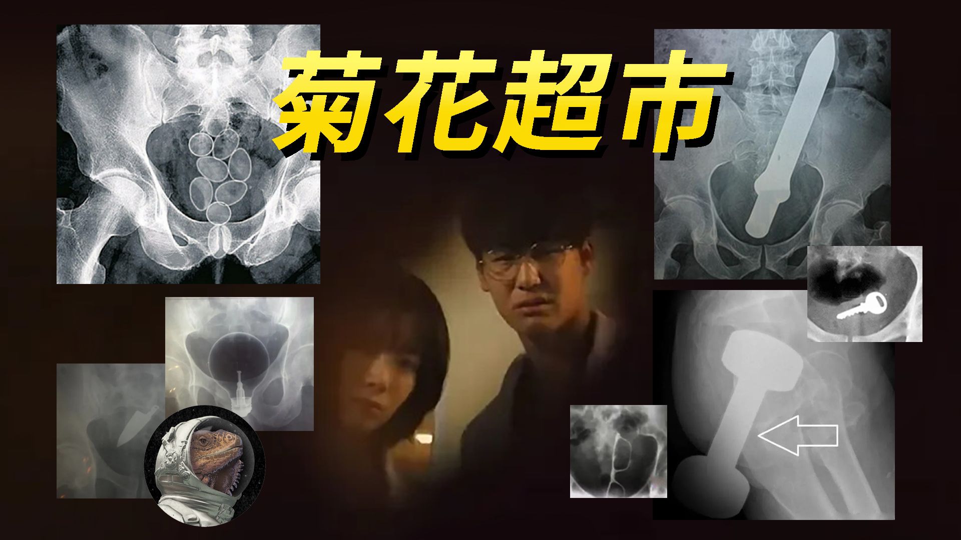 男子将反坦克炮弹塞入菊花,你的容量超乎你的想象!【世奇】