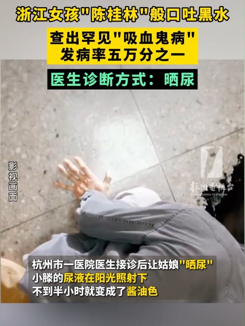 ＂ ＂般口吐黑水,查出罕见“吸血鬼病”!发病率五万分之一!医生诊断方式:晒尿哔哩哔哩bilibili