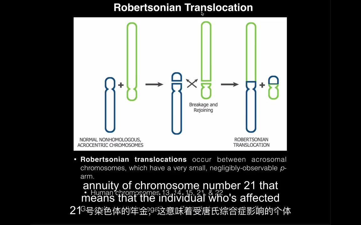 【中英字幕】罗伯逊易位与唐氏综合征Robertsonian Translocations & Correlation to Down Syndrome哔哩哔哩bilibili