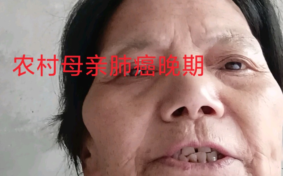 [图]辛苦一辈子，没享过一天福的母亲，受病痛折磨，万般不甘心！