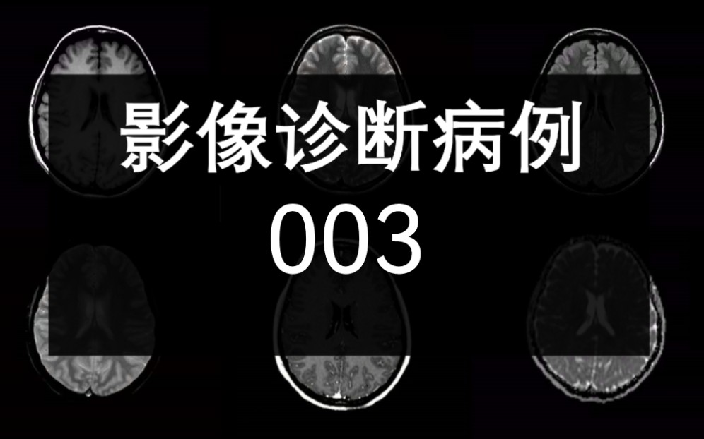 医学影像诊断病例   003期