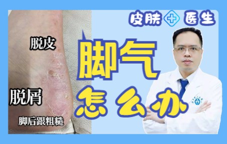 脚后跟粗糙、干裂,这其实也是一种脚气(真菌检查会有菌丝的)哔哩哔哩bilibili