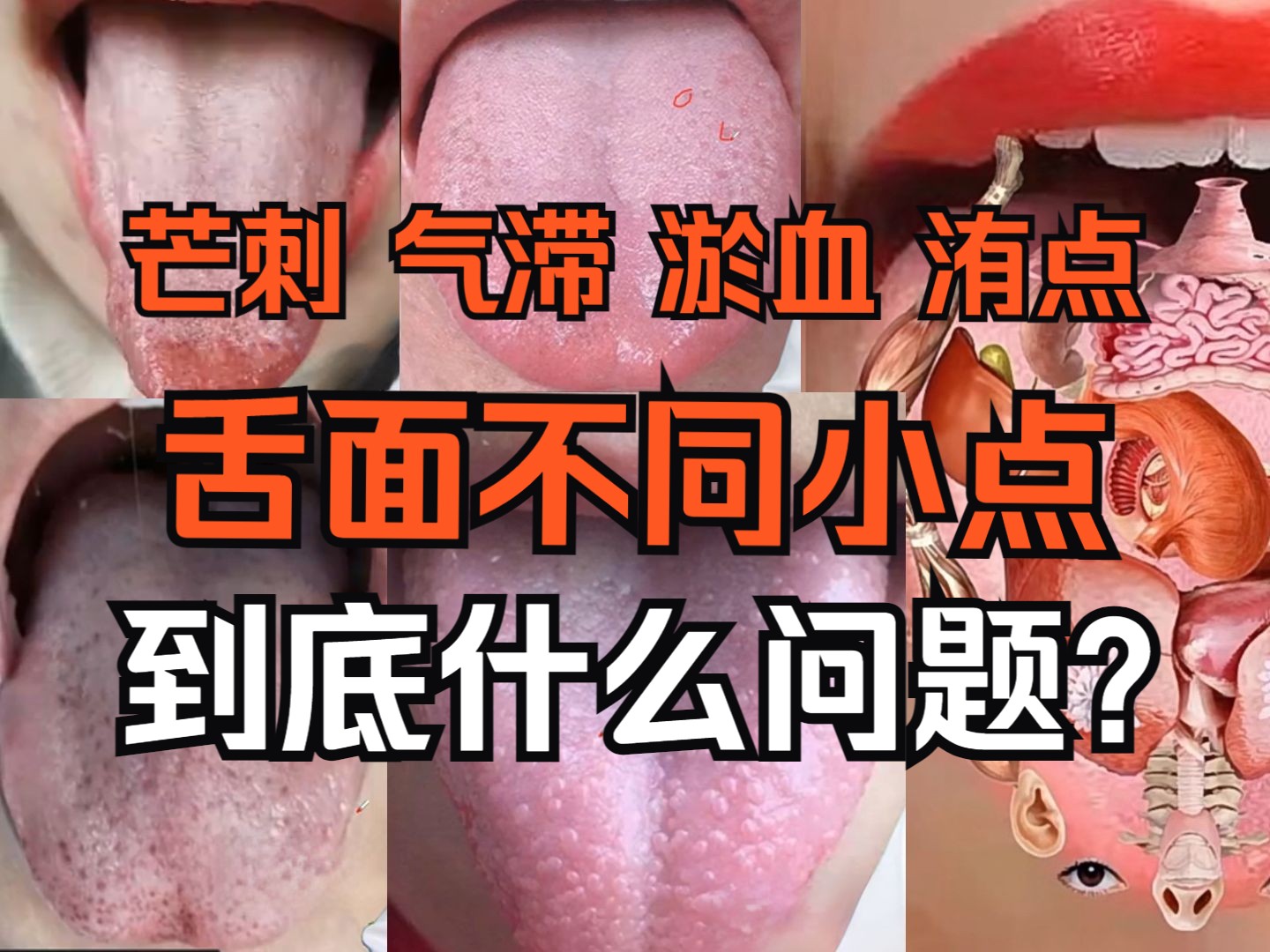 [图]舌面有芒刺？气滞点、血瘀点，洧点。分别什么问题？一次跟你说明白！