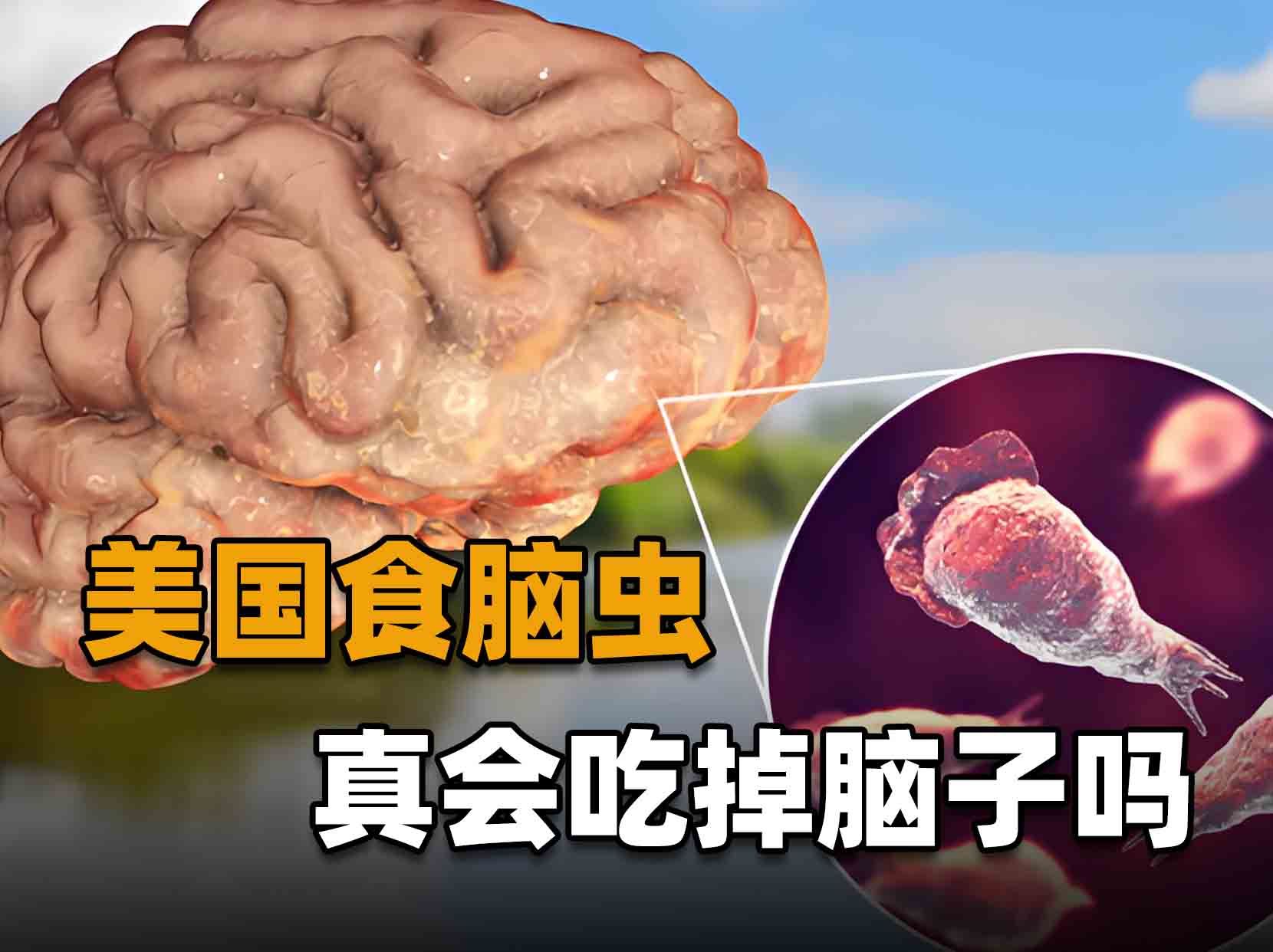 美国惊现食脑虫,致死率高达97%,真的会吃掉你的脑子吗?