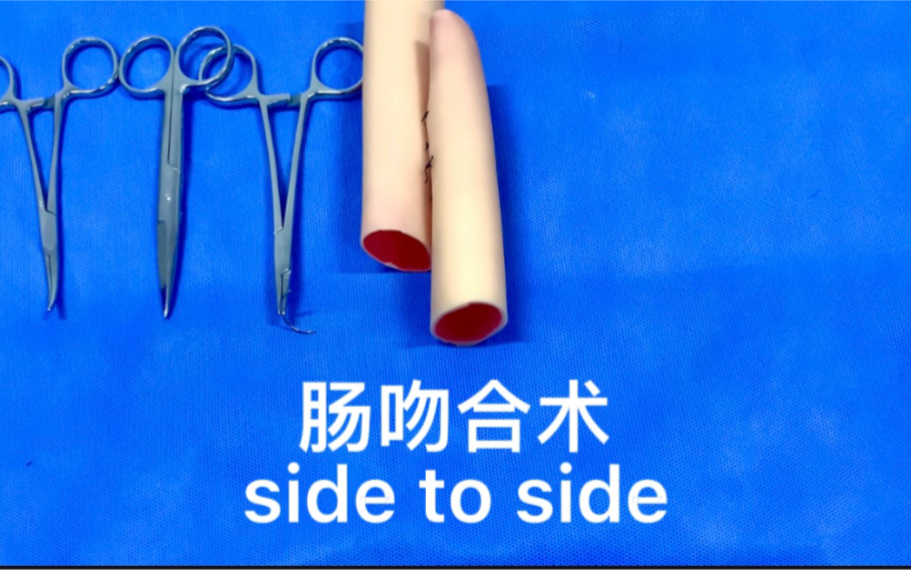 肠吻合术(side to side)哔哩哔哩bilibili