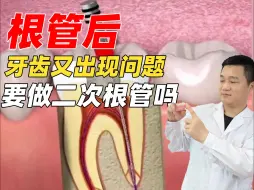 Download Video: 什么情况下需要做二次根管？