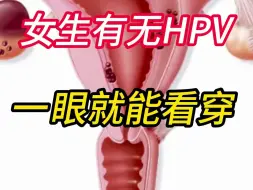 Tải video: 女生有无HPV，一眼就能看穿