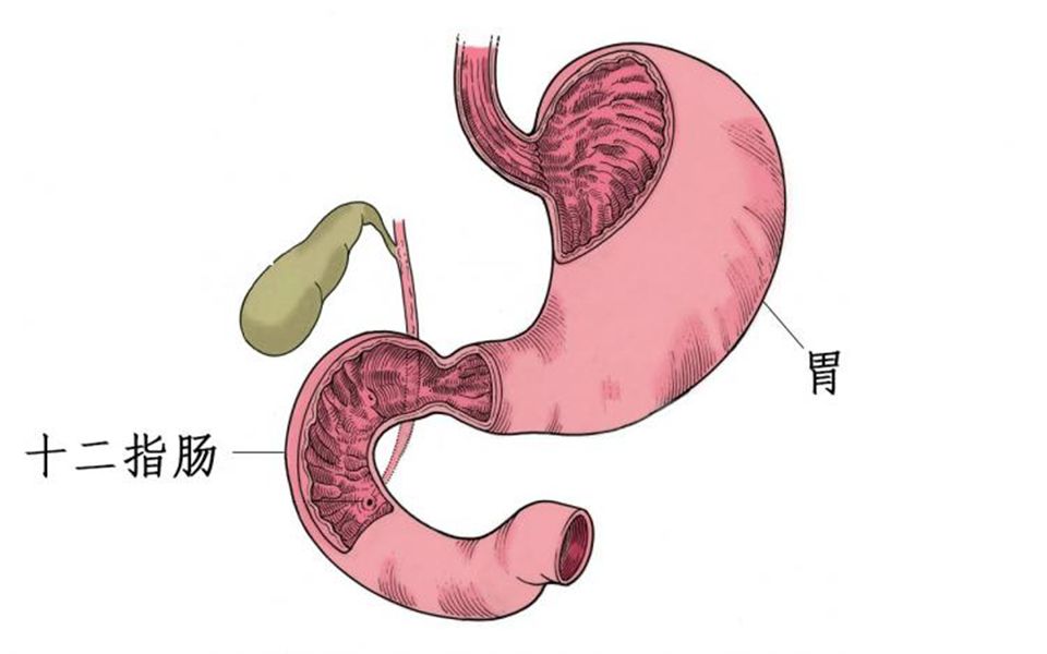 十二指肠炎疼痛位置图图片