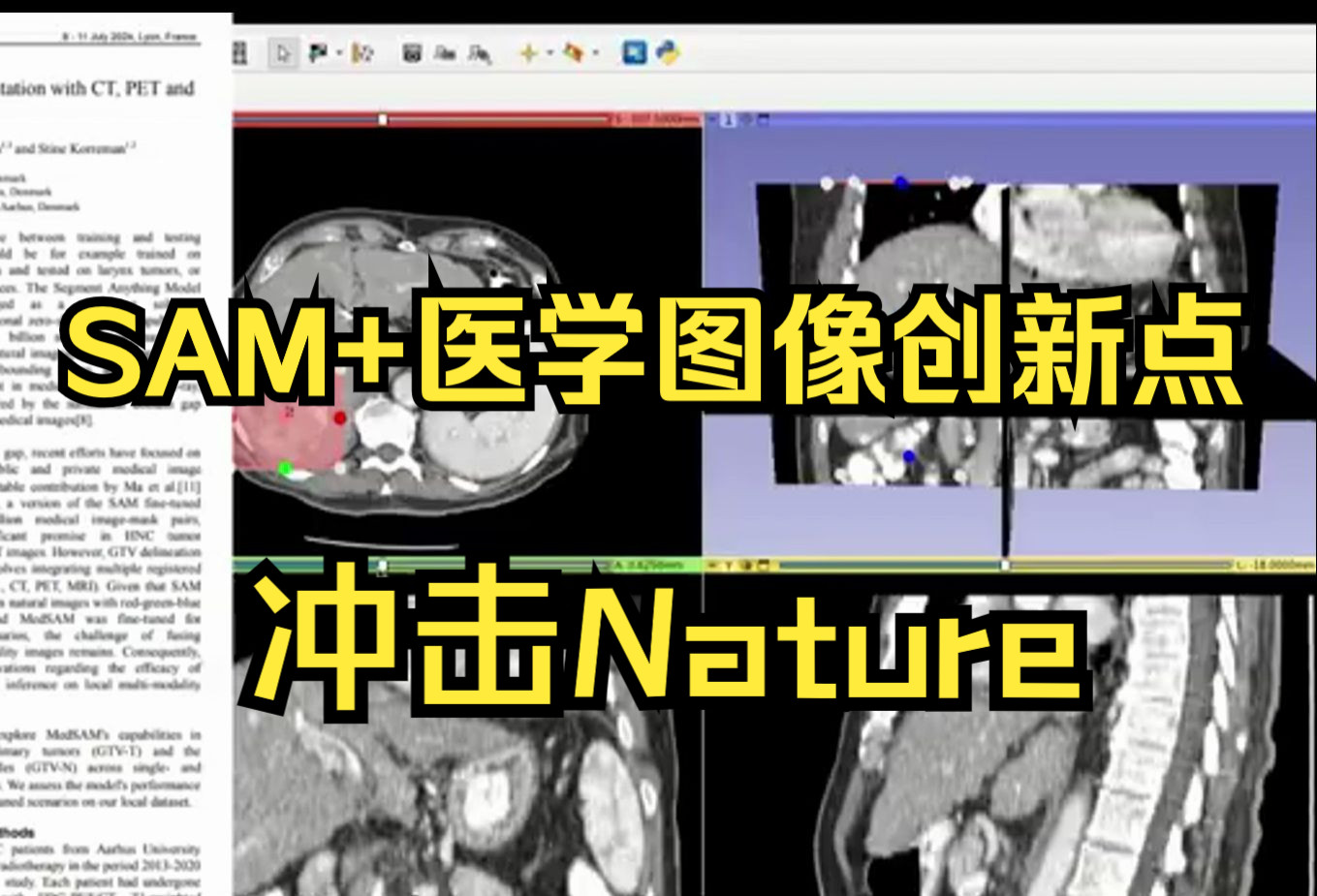 【强推】医学研究生必看的最新11个 SAM+医学图像创新点 冲击Nature! 改进方案+源码复现,SCI|计算机视觉|图像分割哔哩哔哩bilibili