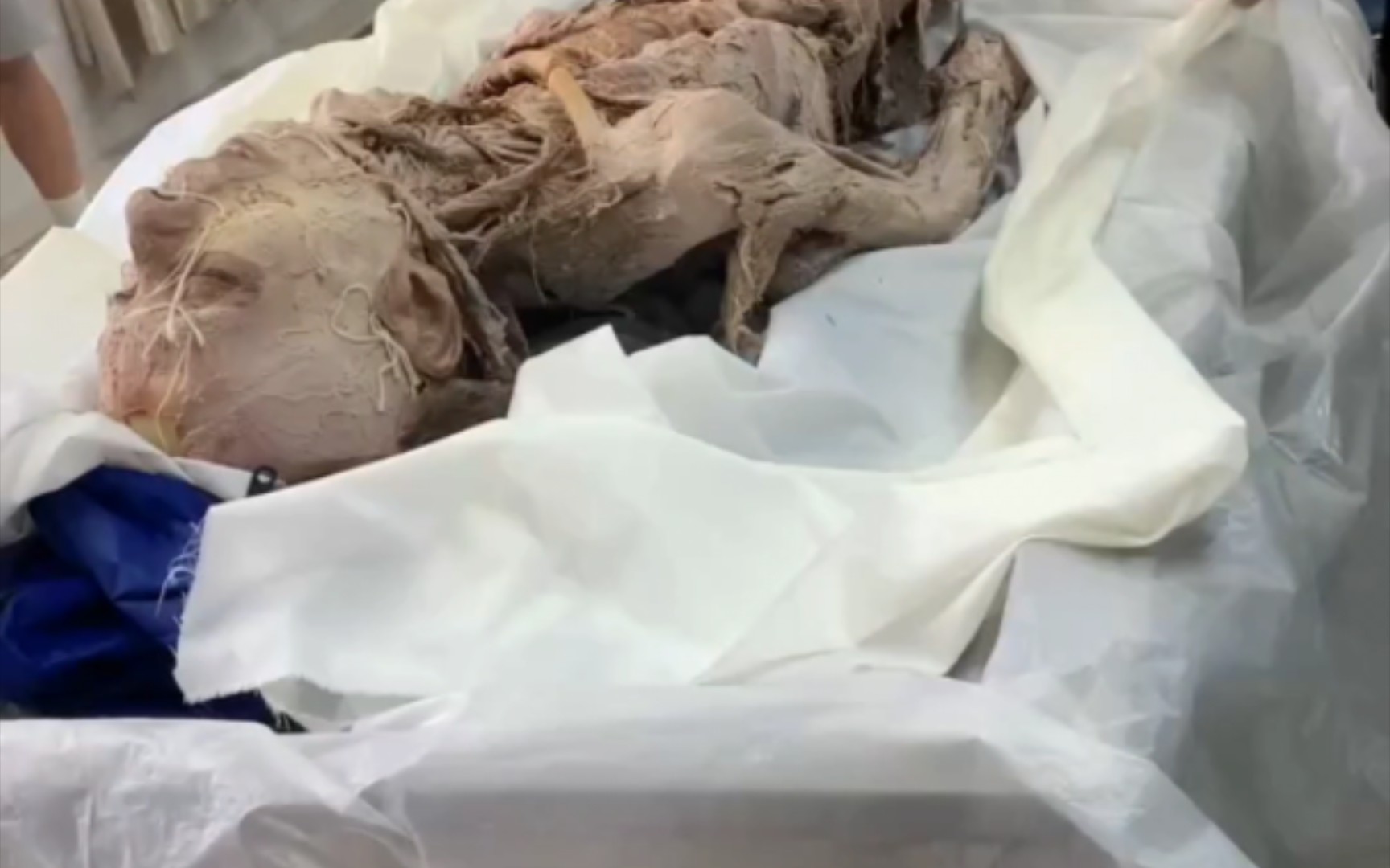 一位同学上解剖课