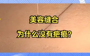 Télécharger la video: 美容缝合为什么没有疤痕？