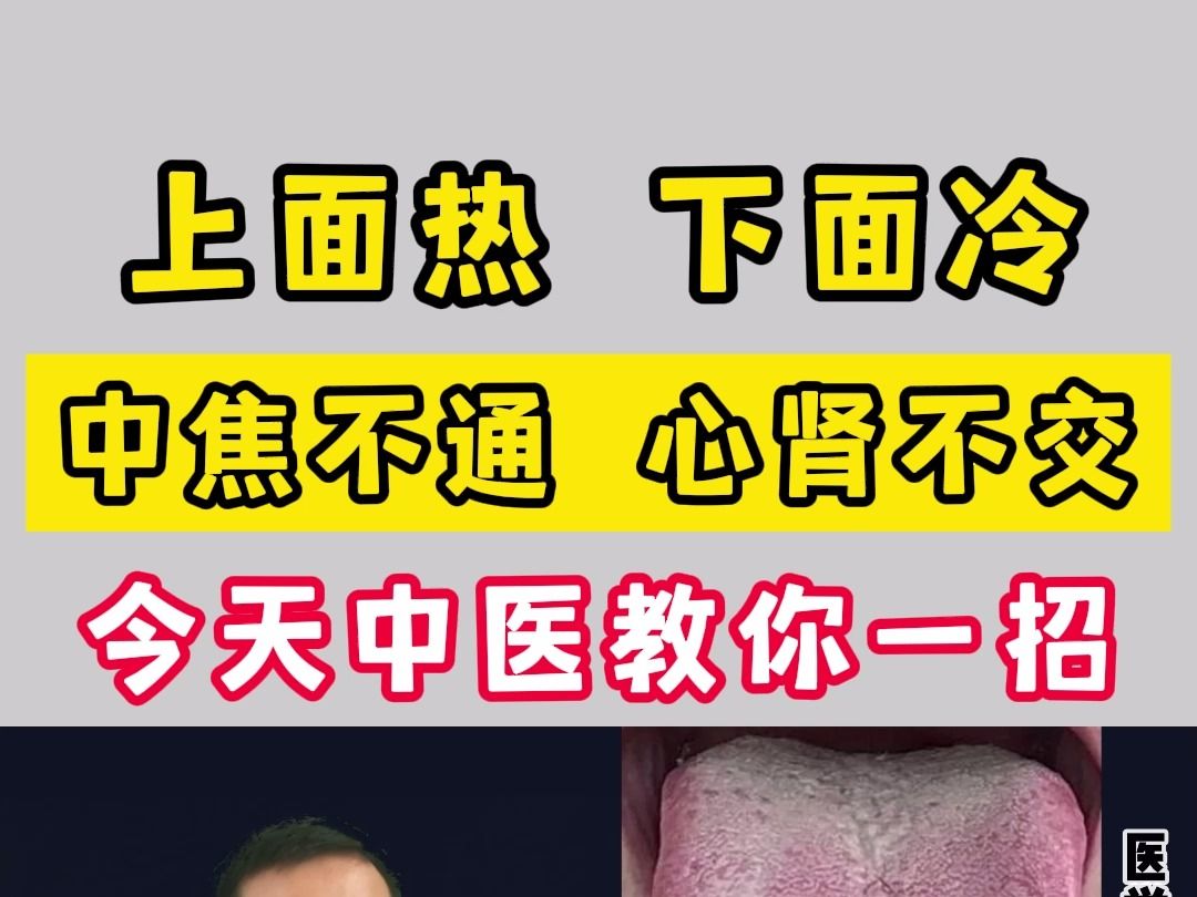 上面热,下面冷,中焦不通,心肾不交,今天中医教你一招