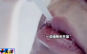 Tải video: 女孩用胶水把男友嘴封上，结果酿成悲剧#好先生#孙红雷