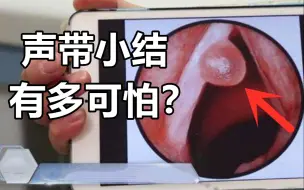 Download Video: 得了这个病，你基本可以告别唱歌了！预防【声带小结】