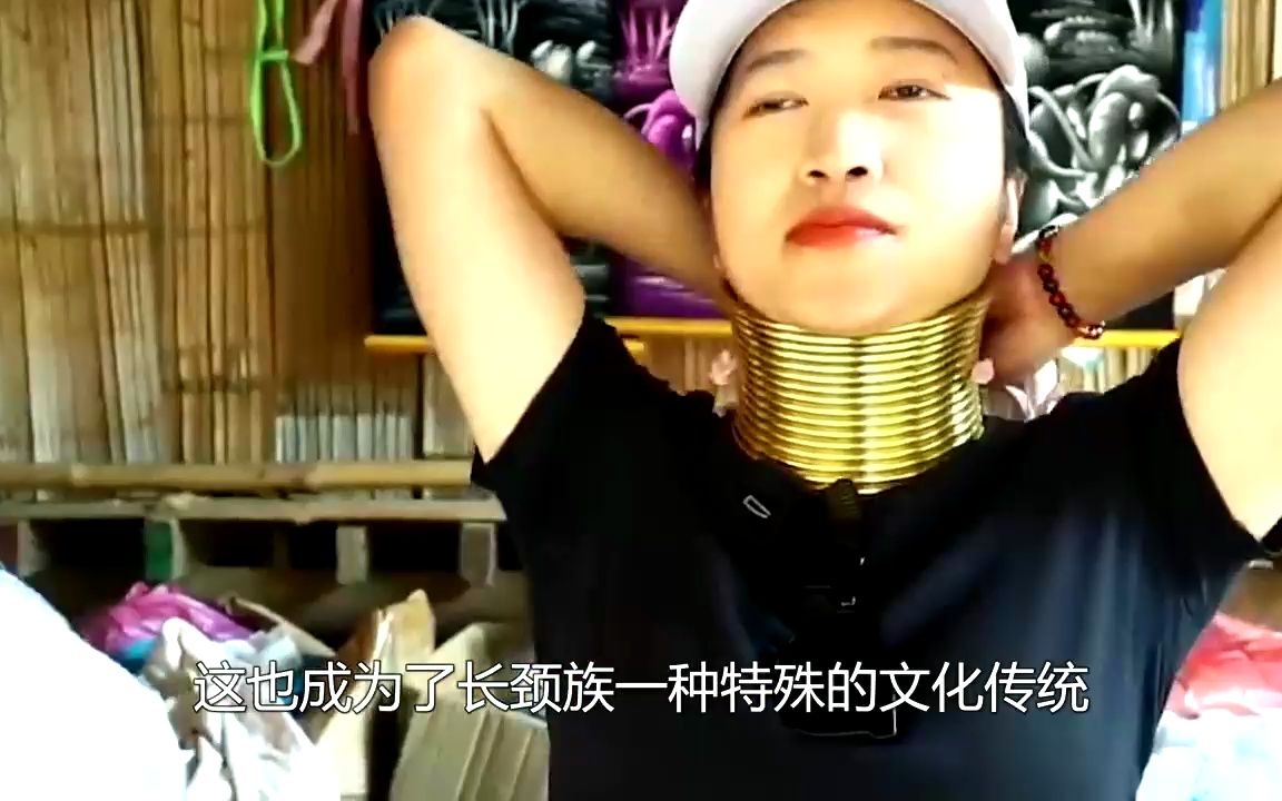 戴了10年项圈的长颈族女人,当摘下项圈,脖子会是什么样