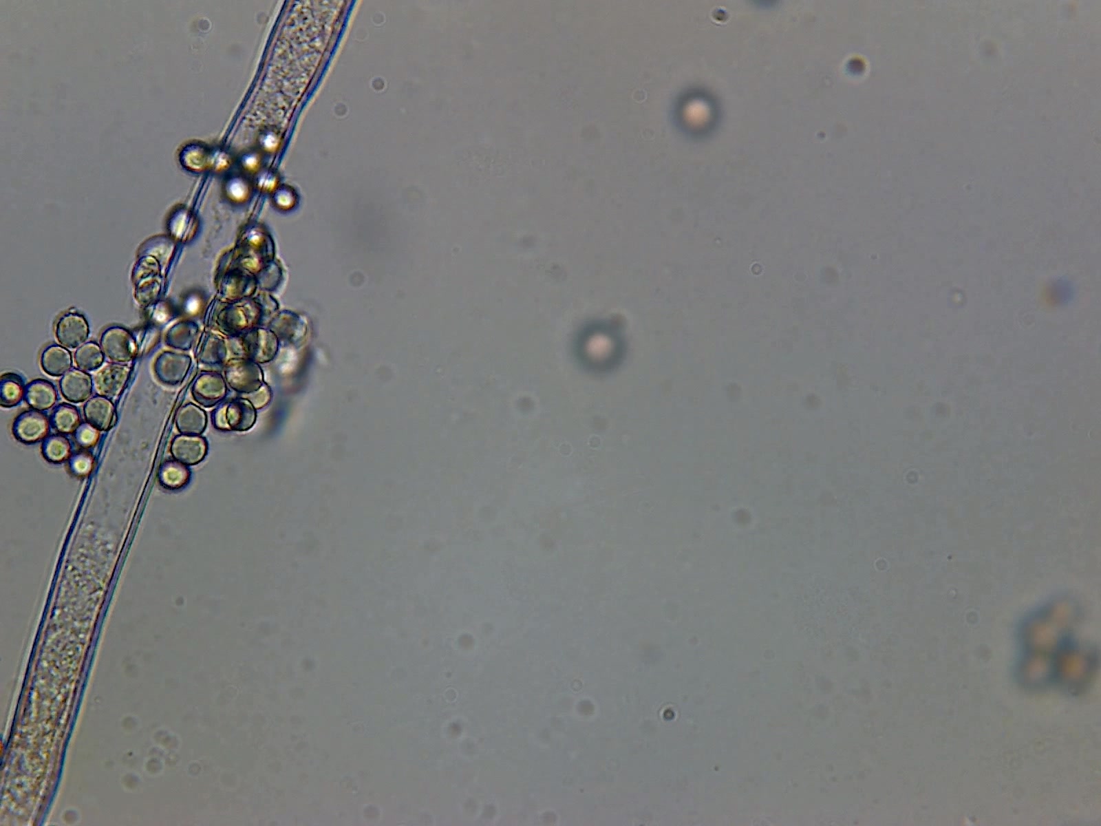 【自制】光学显微镜下的霉菌