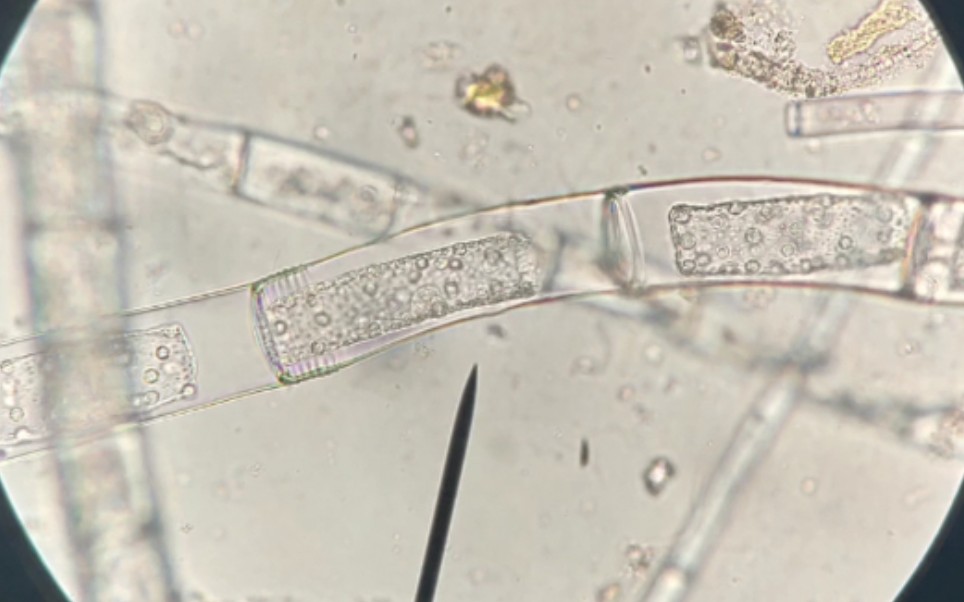 B站最强绿藻门大全!!!绿藻门又分绿藻纲和接合藻纲.学习显微镜查找水中藻类是一个有趣的过程,就是有点费眼::D哔哩哔哩bilibili