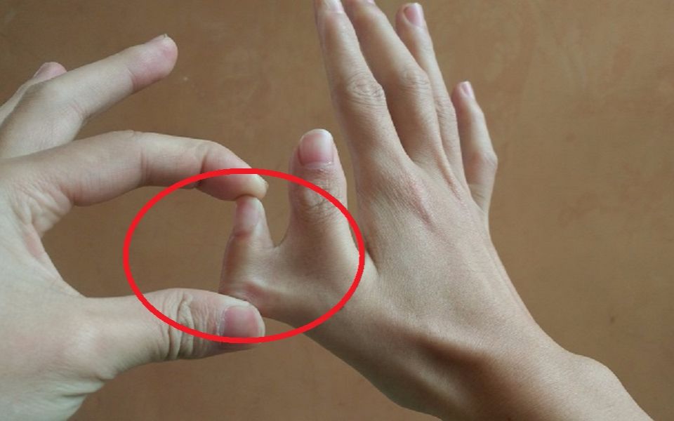 六个指头怎么拿筷子吃饭?现在一次性为你解惑!