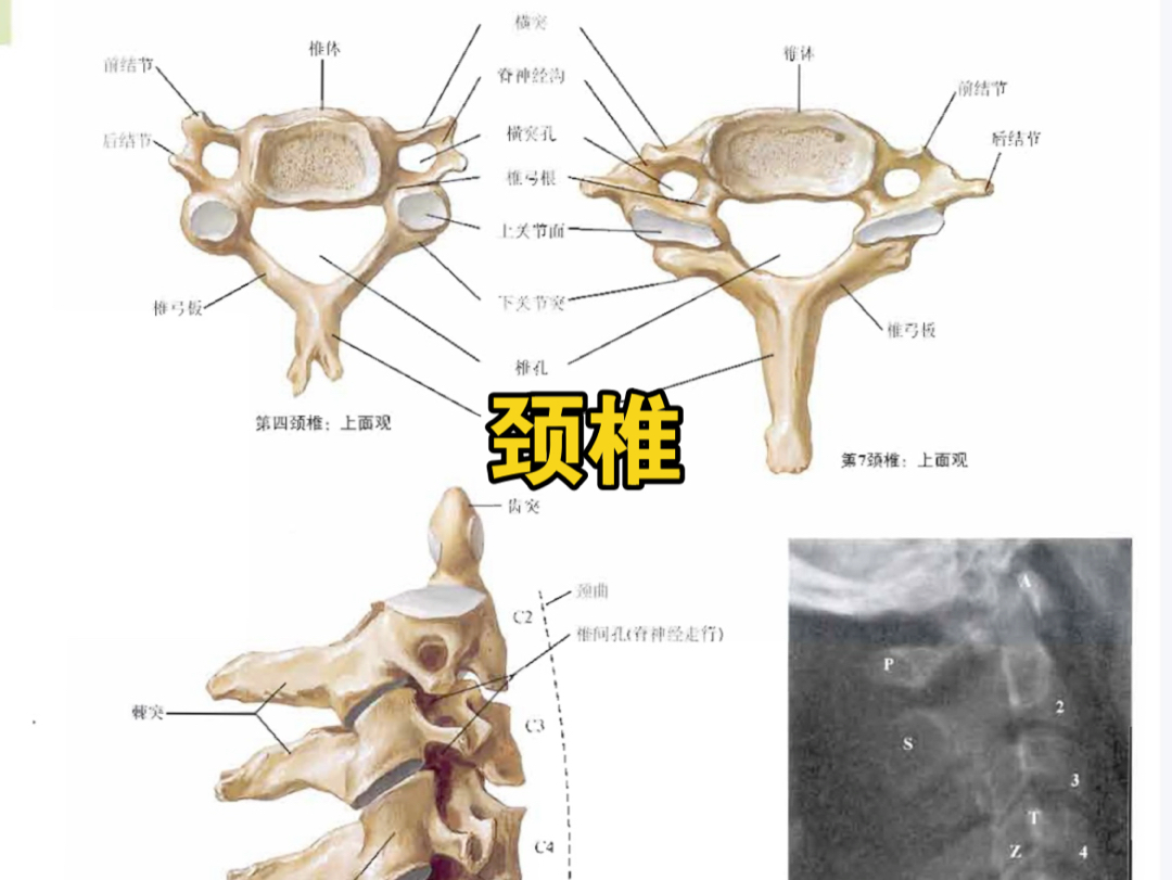 颈椎 奈特博士.解剖图谱哔哩哔哩bilibili