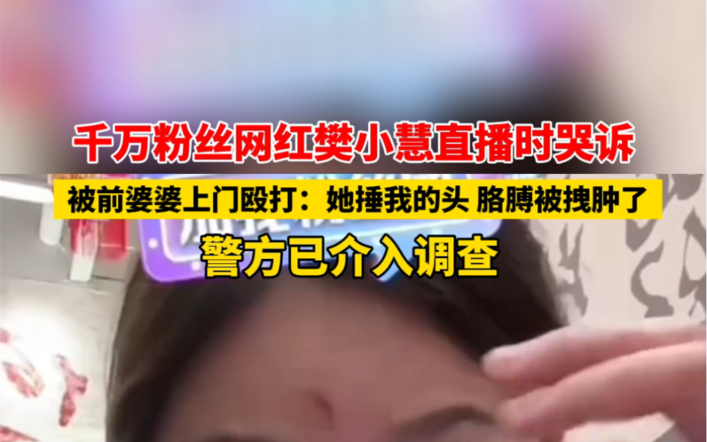 #警方介入网红樊小慧称被前婆婆殴打 千万粉丝网红樊小慧直播时哭诉被前婆婆上门殴打:她捶我的头,胳膊被拽肿了,警方已介入调查.哔哩哔哩bilibili