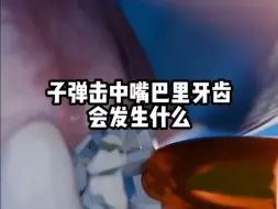 子弹击中嘴巴里的牙齿，会发生什么？