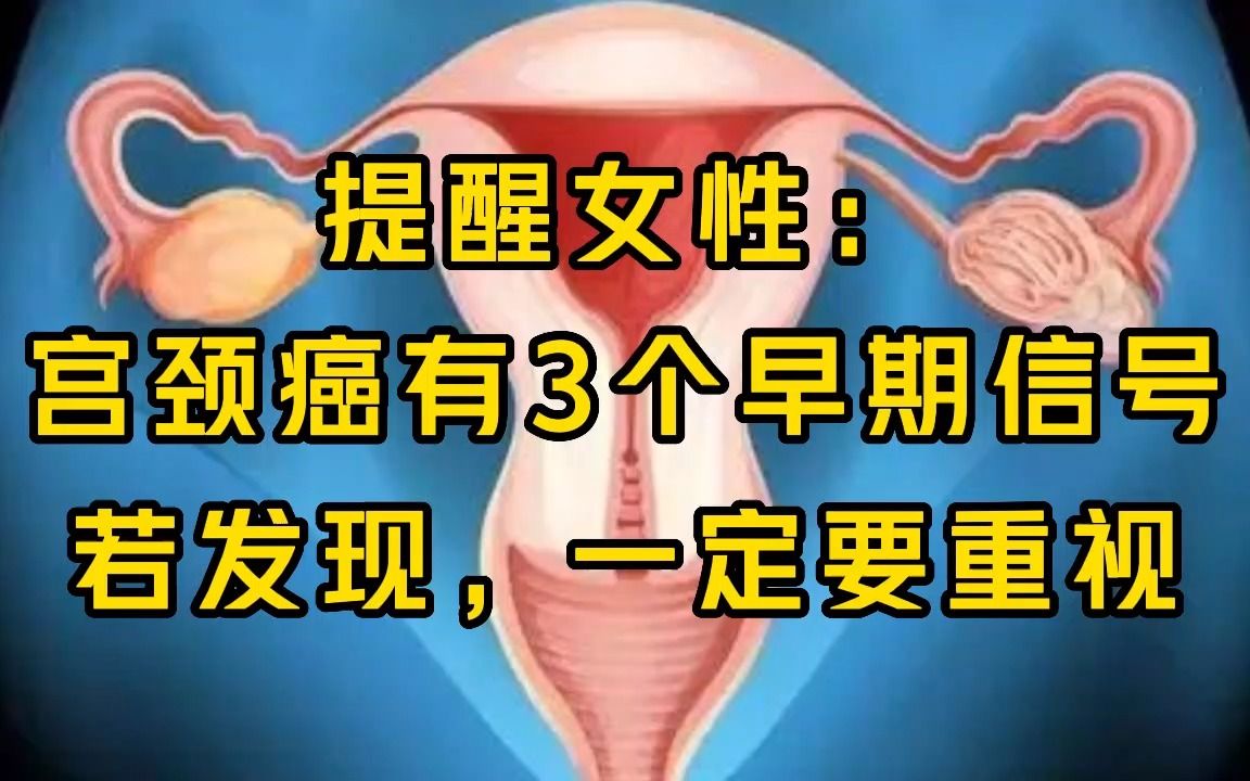 提醒女性:宫颈癌有3个早期信号,若发现,一定要重视哔哩哔哩bilibili