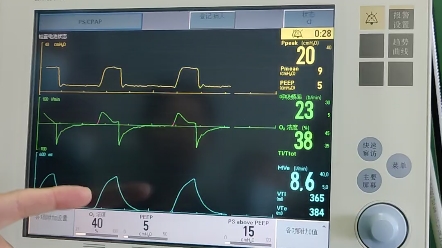[图]呼吸机的模式和参数设置