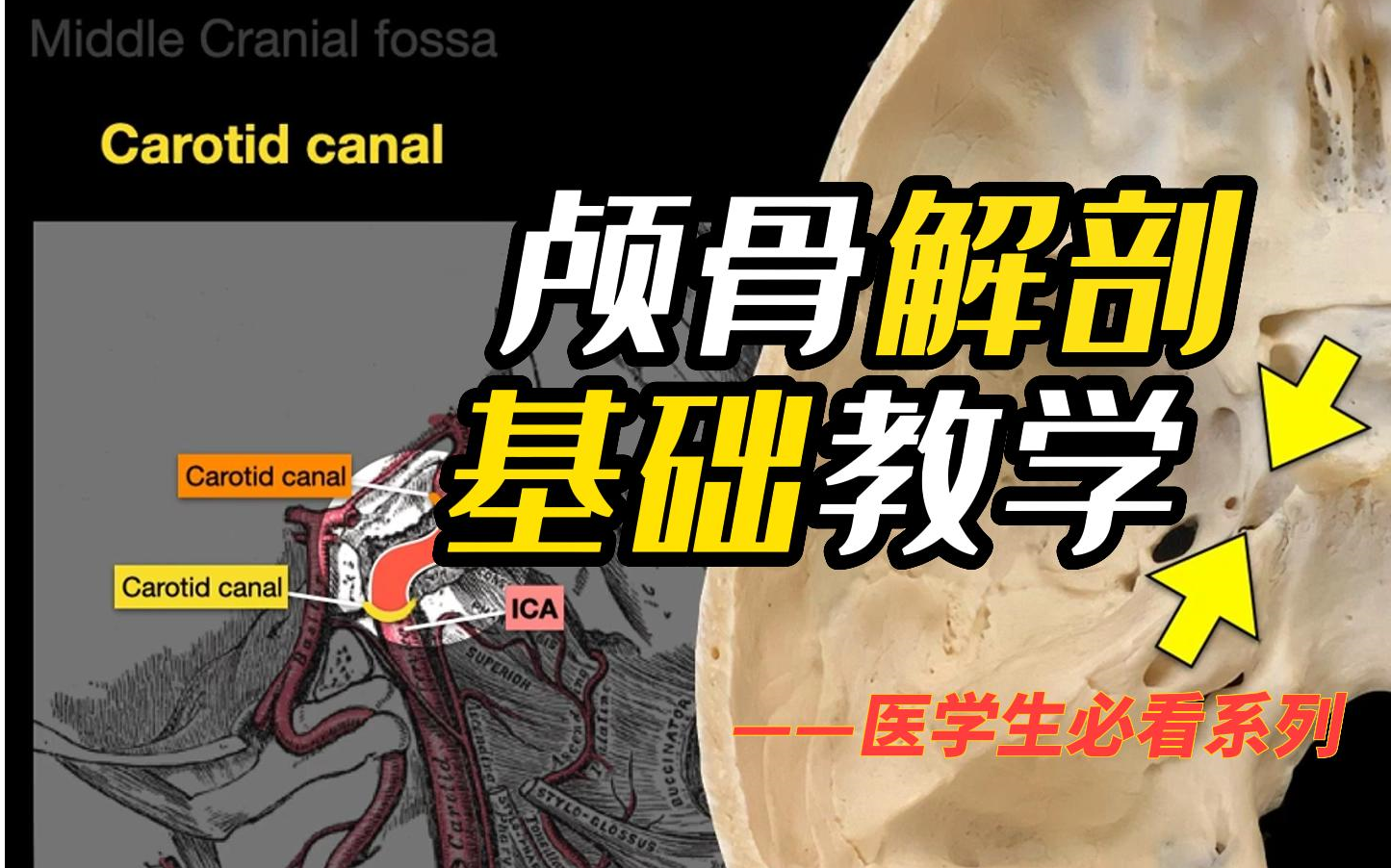 颅骨解剖基础教学哔哩哔哩bilibili