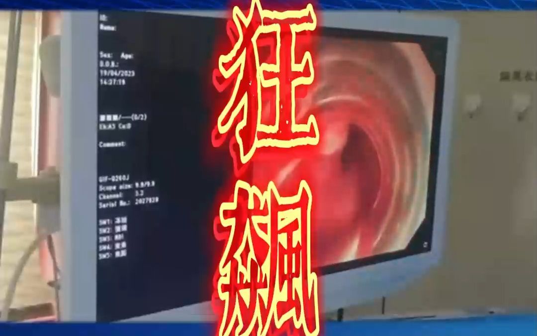 如何应对食管静脉曲张血流汹涌? 内镜下套扎治疗,一套一扎快速止血 ——感谢马鞍山市人民医院消化内科黄建刚老师的分享哔哩哔哩bilibili