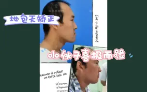 Download Video: 地包天矫正术后第一天，小伙子喜极而泣！