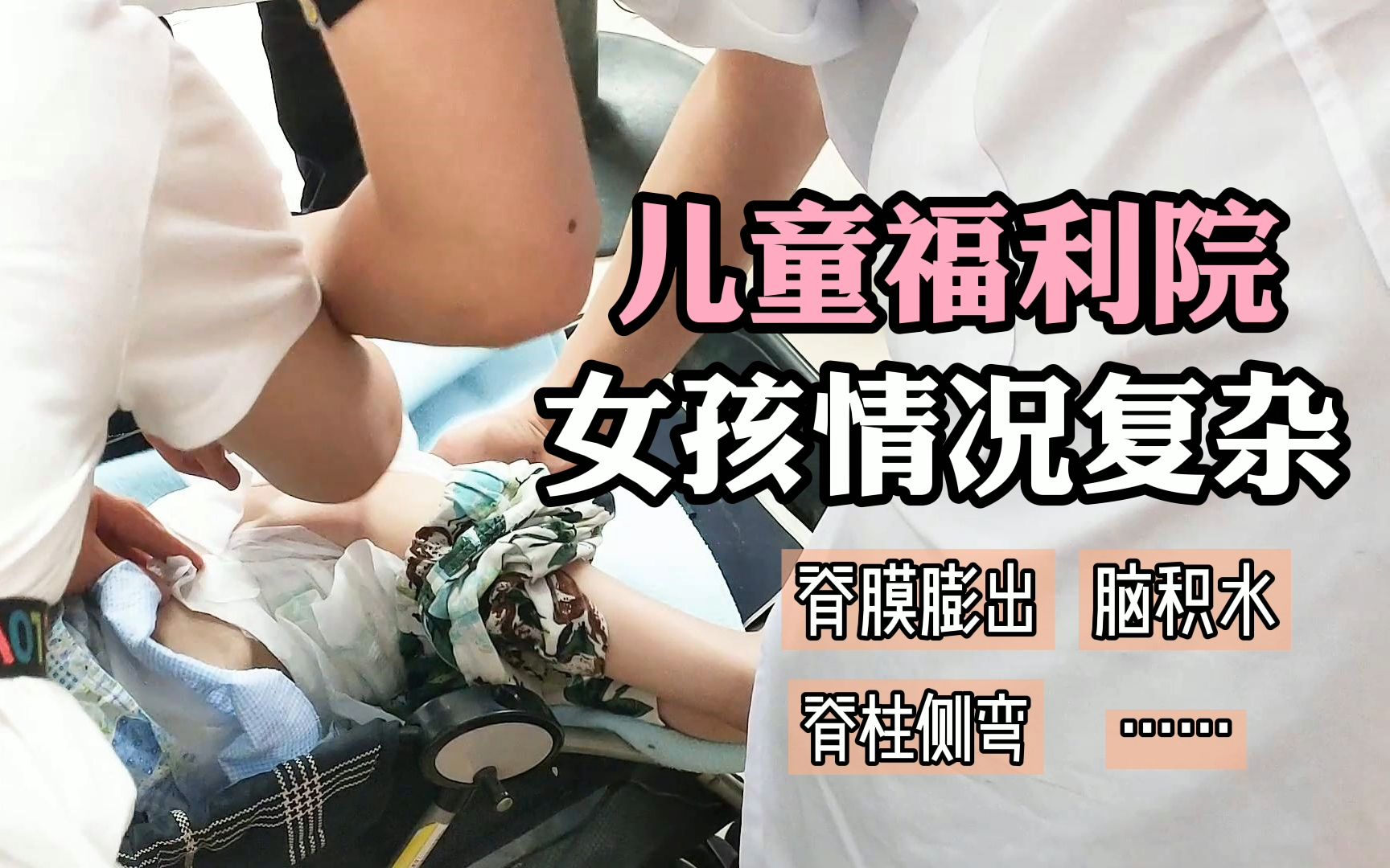 活动  神经外科诊室里,两位儿童福利院的脑积水女孩情况有些复杂