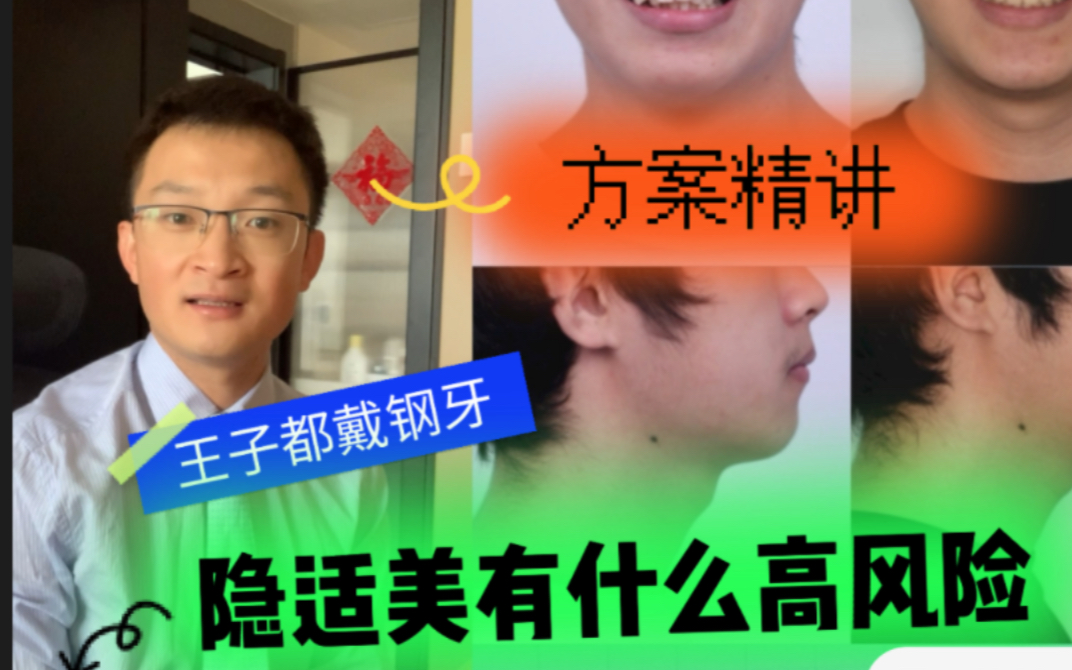 隐适美治疗青少年的功与过,方案讲解哔哩哔哩bilibili