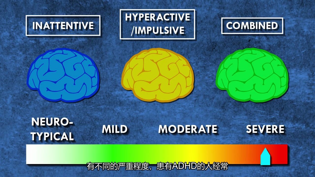什么是多动症(ADHD),它的定义是什么?_哔哩哔哩_bilibili