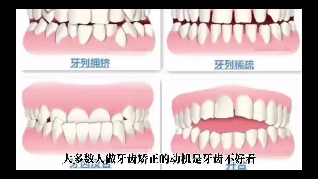 口腔正畸攻略三大类牙齿矫治器,矫正牙齿后口腔溃疡哔哩哔哩bilibili