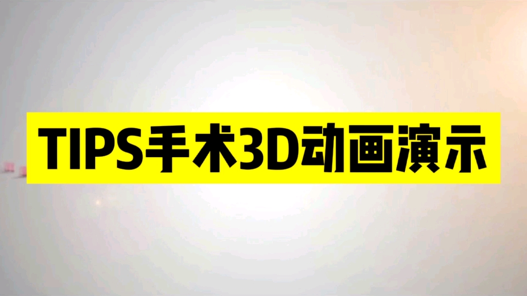 肝炎，肝硬化，腹水，胃底静脉出血，TIPS手术3D动画原理，辅助学习。