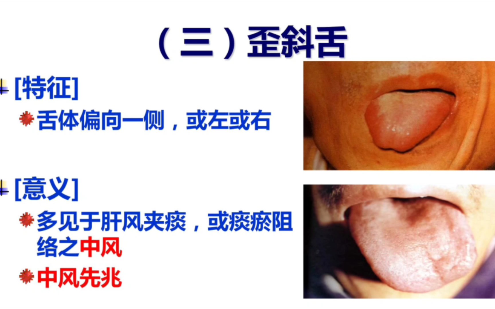 从零开始学中医:望舌态