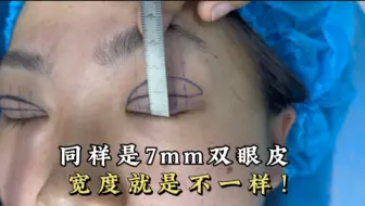 Tải video: 同样是7mm双眼皮，宽度就是不一样！