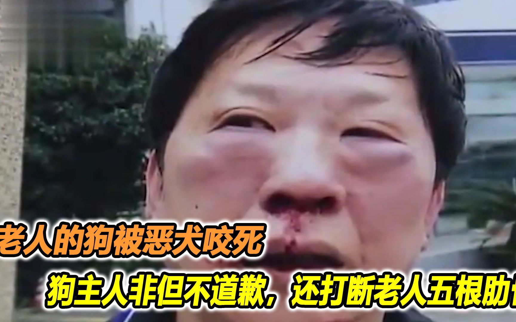 老人的狗被恶犬咬死,狗主人非但不道歉,还打断老人五根肋骨